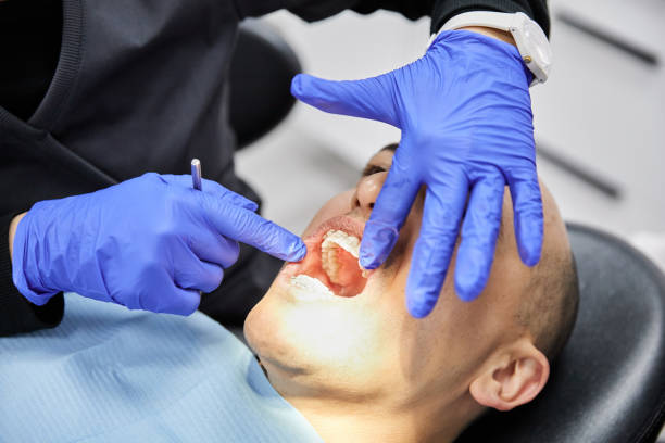 Best Dentist for Tooth Abscess  in Laton, CA