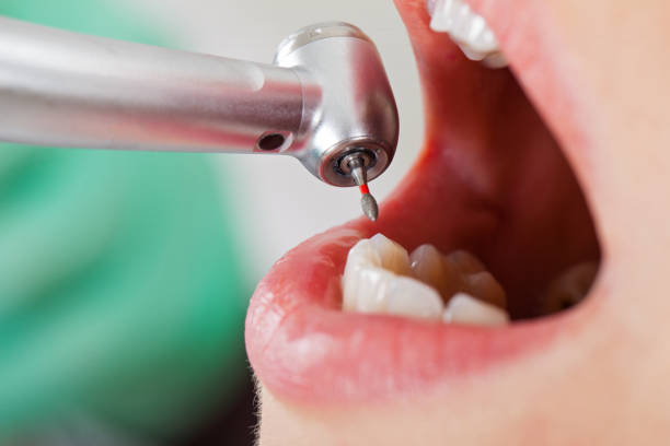 Best Tooth Infection Emergency Dentist  in Laton, CA